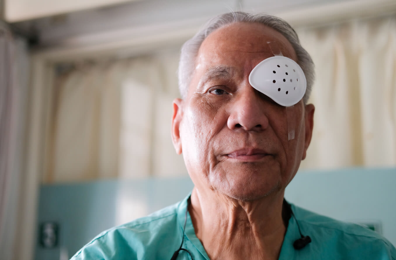 Read more about the article Everything You Need to Know About Cataracts Surgery: A Complete Guide